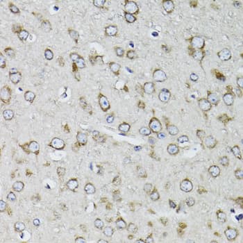 RPS10 / Ribosomal Protein S10 Antibody
