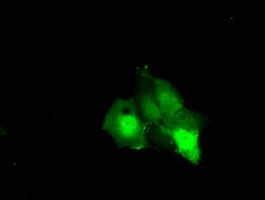 Monoclonal Mouse anti-Human KHK / Ketohexokinase Antibody (clone OTI2C3, IF, WB)