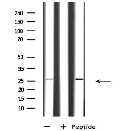 Polyclonal Rabbit anti-Human RAB26 Antibody (WB)