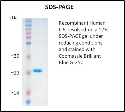 Human IL6 / Interleukin 6 Protein (Recombinant)