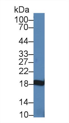NME3 Antibody (aa1-168)