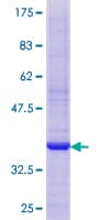 Human GPX5 Protein (Recombinant GST)