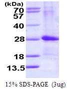 Human ARL4D Protein (Recombinant His)