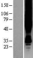 GPER1 / GPR30 Protein (Over-Expression Lysate Myc-DDK (Flag))