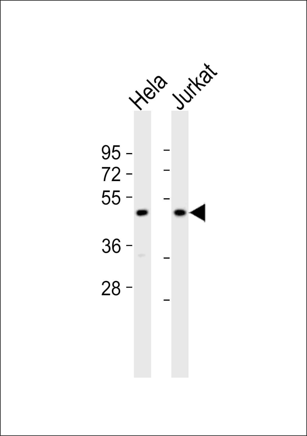 MTERF1 Antibody