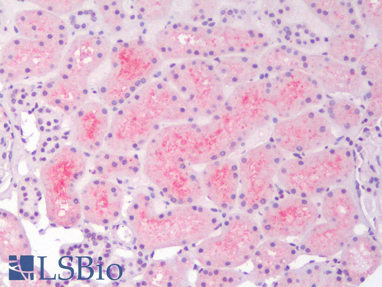 PathPlus™ Polyclonal Rabbit anti-Human PIK3CA / PI3K Alpha Antibody (IHC)