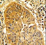 CALD1 / Caldesmon Antibody (aa428-457)