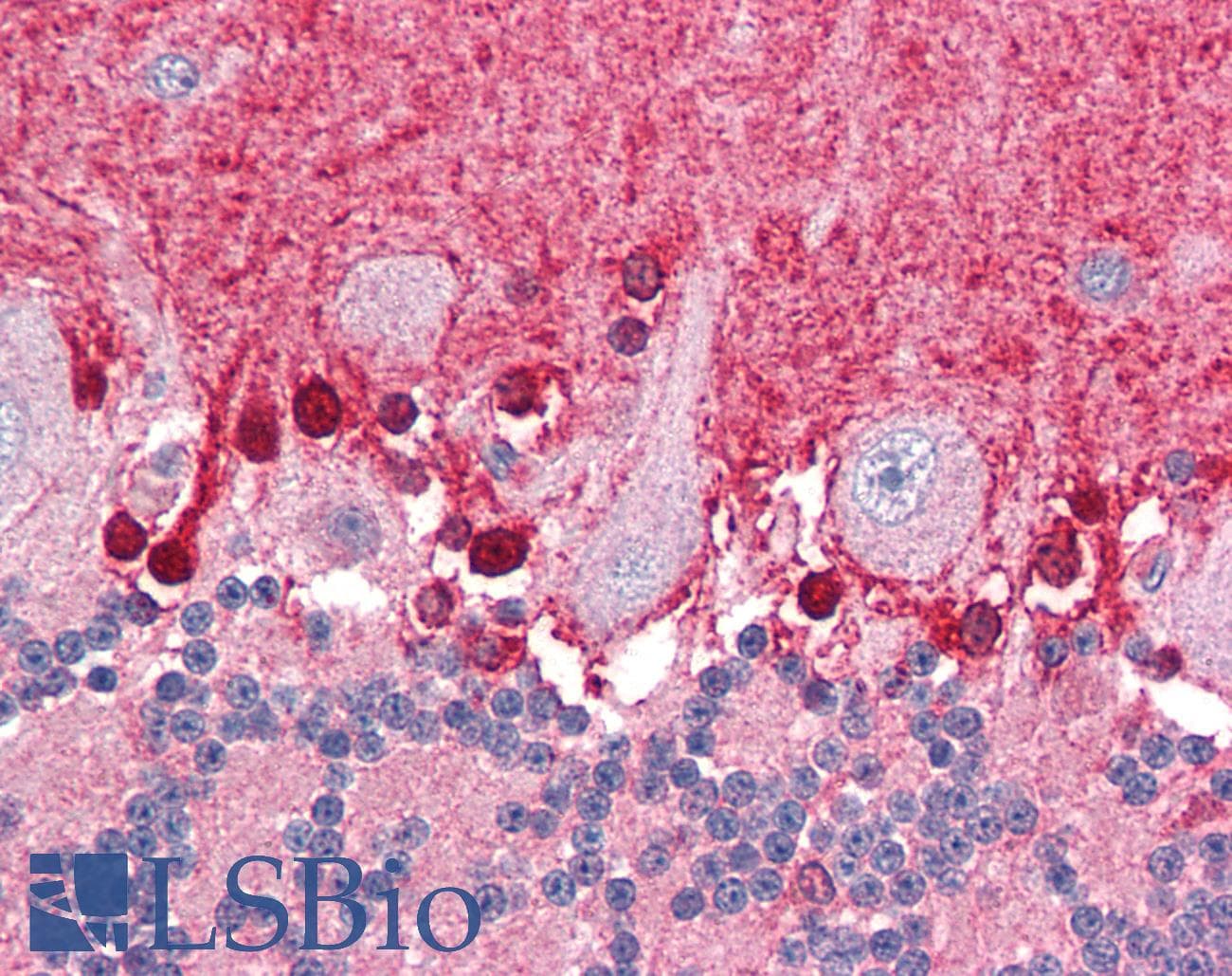 IHC-plus™ Polyclonal Goat anti-Human BPOZ / ABTB1 Antibody (aa465-478, IHC, WB)