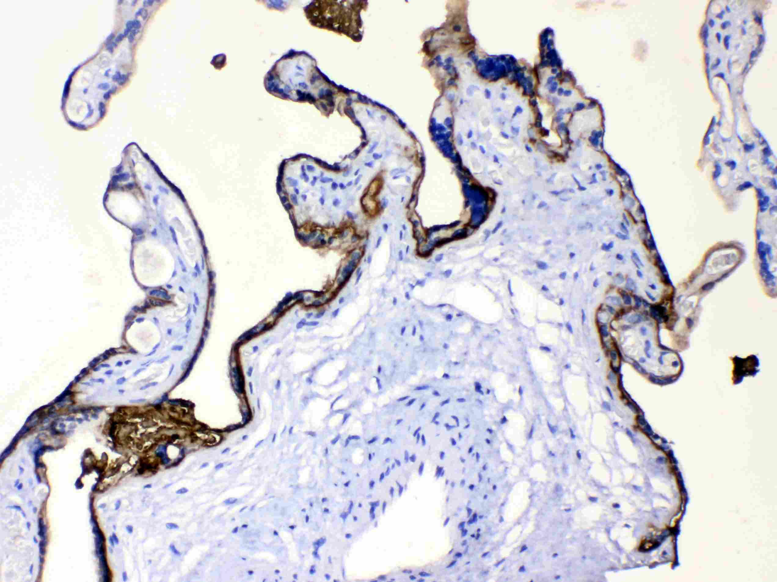 PLAP / Alkaline Phosphatase Antibody