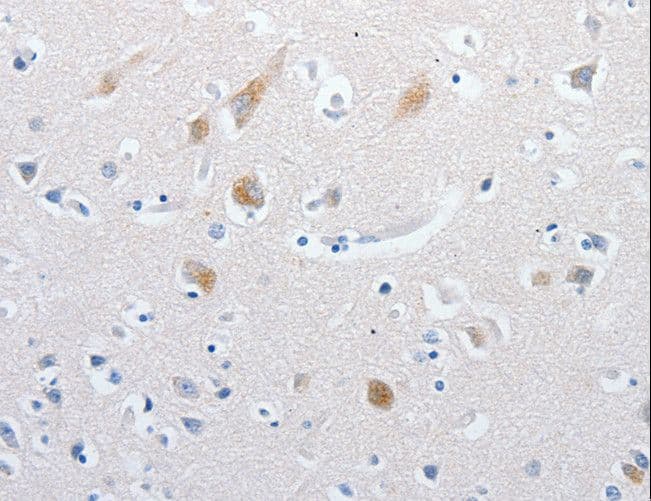Polyclonal Rabbit anti-Human MATN1 / Matrilin 1 Antibody (IHC)