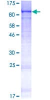 Human C5orf34 Protein (Recombinant GST)