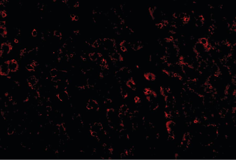 LDLR / LDL Receptor Antibody