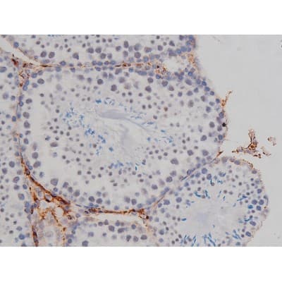 NPM1 / NPM / Nucleophosmin Antibody (phospho-Thr199)