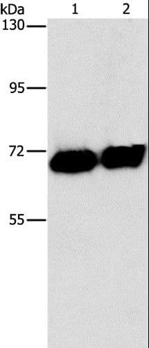 PLAP / Alkaline Phosphatase Antibody