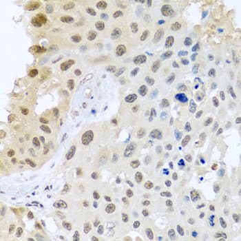 DNAL1 Antibody
