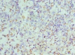Polyclonal Rabbit anti-Human HNRNPD / AUF1 Antibody (aa1-306, IHC, WB)