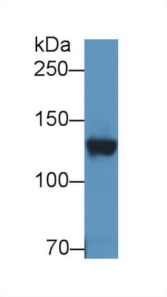 DPP6 / Dipeptidylpeptidase 6 Antibody (aa667-865)