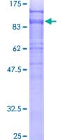 Human DAB2 Protein (Recombinant GST)