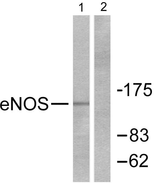 NOS3 / eNOS Antibody (p1176)