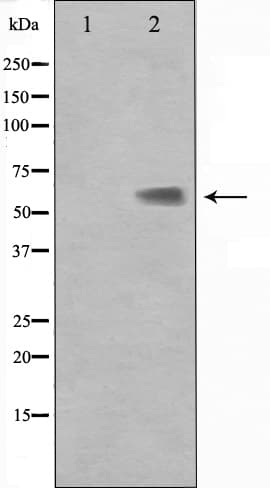 KLF11 Antibody