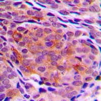 TPT1 / TCTP Antibody (Internal)