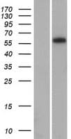ARID5A Protein (Over-Expression Lysate Myc-DDK (Flag))