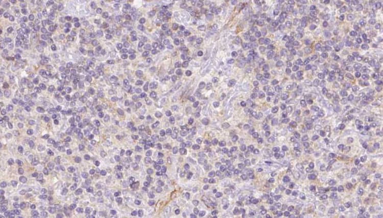 Polyclonal Rabbit anti-Human FECH / Ferrochelatase Antibody (IHC, IF, WB)