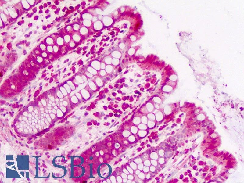 IHC-plus™ Polyclonal Rabbit anti-Human PUM2 Antibody (aa133-162, IHC, WB)