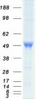 Human CASQ2 / Calsequestrin 2 Protein (Recombinant Myc-DDK (Flag))