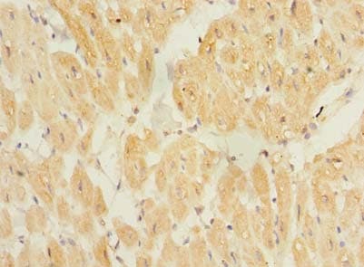 TP53TG5 Antibody