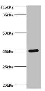 SULT1B1 / Sulfotransferase 1B1 Antibody (aa1-271)