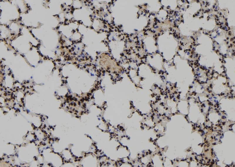 Polyclonal Rabbit anti-Human RCD1 / RQCD1 Antibody (IHC, WB)