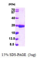 Human NUDT3 Protein (Recombinant His)