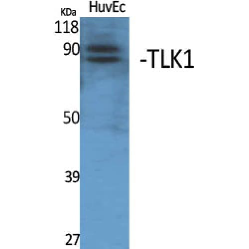 Polyclonal Rabbit anti-Human TLK1 Antibody (180-260 aa, Internal, WB)