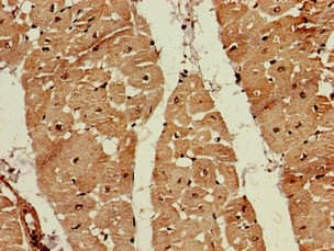 Polyclonal Rabbit anti-Human FDPS Antibody (IHC, WB)