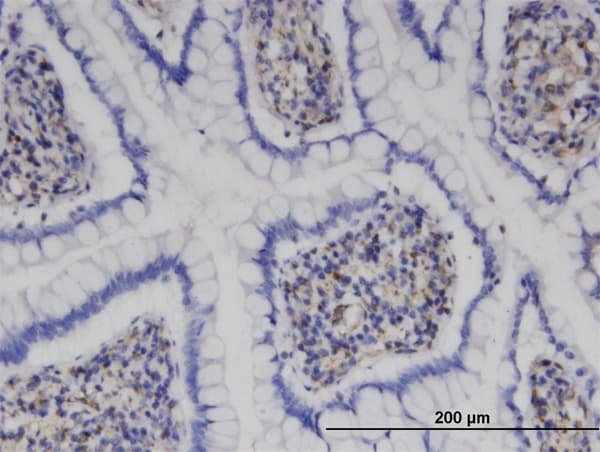 Monoclonal Mouse anti-Human MPHOSPH9 Antibody (clone 4E10, IHC, WB)