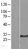DHRS11 / MGC4172 Protein (Over-Expression Lysate Myc-DDK (Flag))