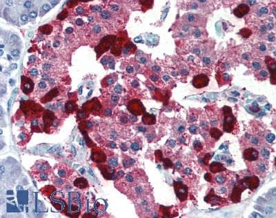 Polyclonal Rabbit anti-Human GLP2 Antibody (IHC, WB)