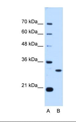PSME3 Antibody (aa48-97)
