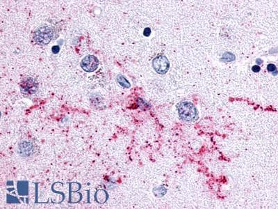 PathPlus™ Polyclonal Rabbit anti-Human MCHR2 Antibody (Cytoplasmic Domain, IHC)