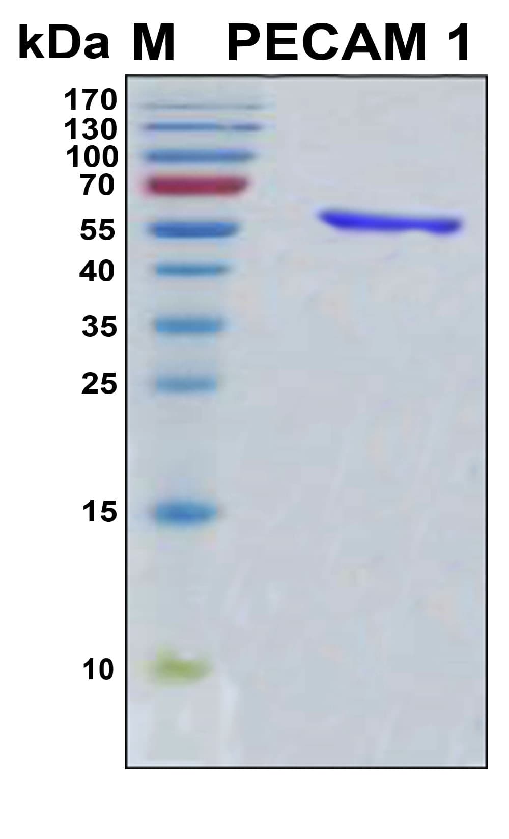 Human PECAM-1 / CD31 Protein (Recombinant 6His, N-terminus)