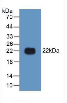 Human LGALS9 / Galectin 9 Protein (Recombinant His-GST, N-terminus)