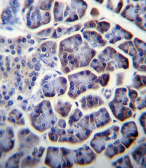 PC / Pyruvate Carboxylase Antibody (aa53-82)