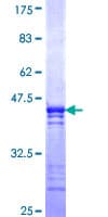Human COLQ Protein (Recombinant GST, N-terminus)