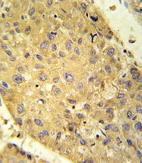 Polyclonal Rabbit anti-Human GLS2 / Glutaminase 2 Antibody (aa498-524, IHC, WB)