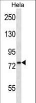 IHC-plus™ Polyclonal Rabbit anti-Human PDIA4 / ERP72 Antibody (aa9-37, IHC, WB)