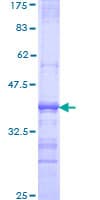 Human SORT1 / Sortilin Protein (Recombinant GST, N-terminus)