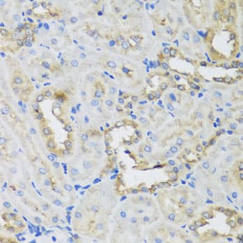 AHCYL1 / DCAL Antibody