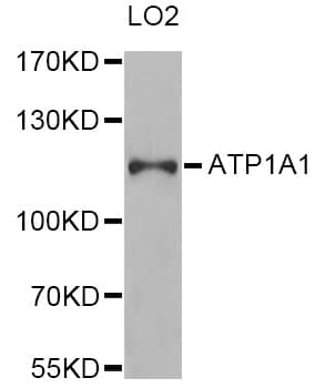 IHC-plus™ ATP1A1 Antibody