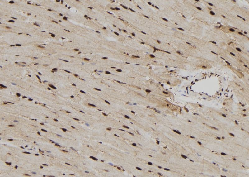 RPS6KL1 Antibody